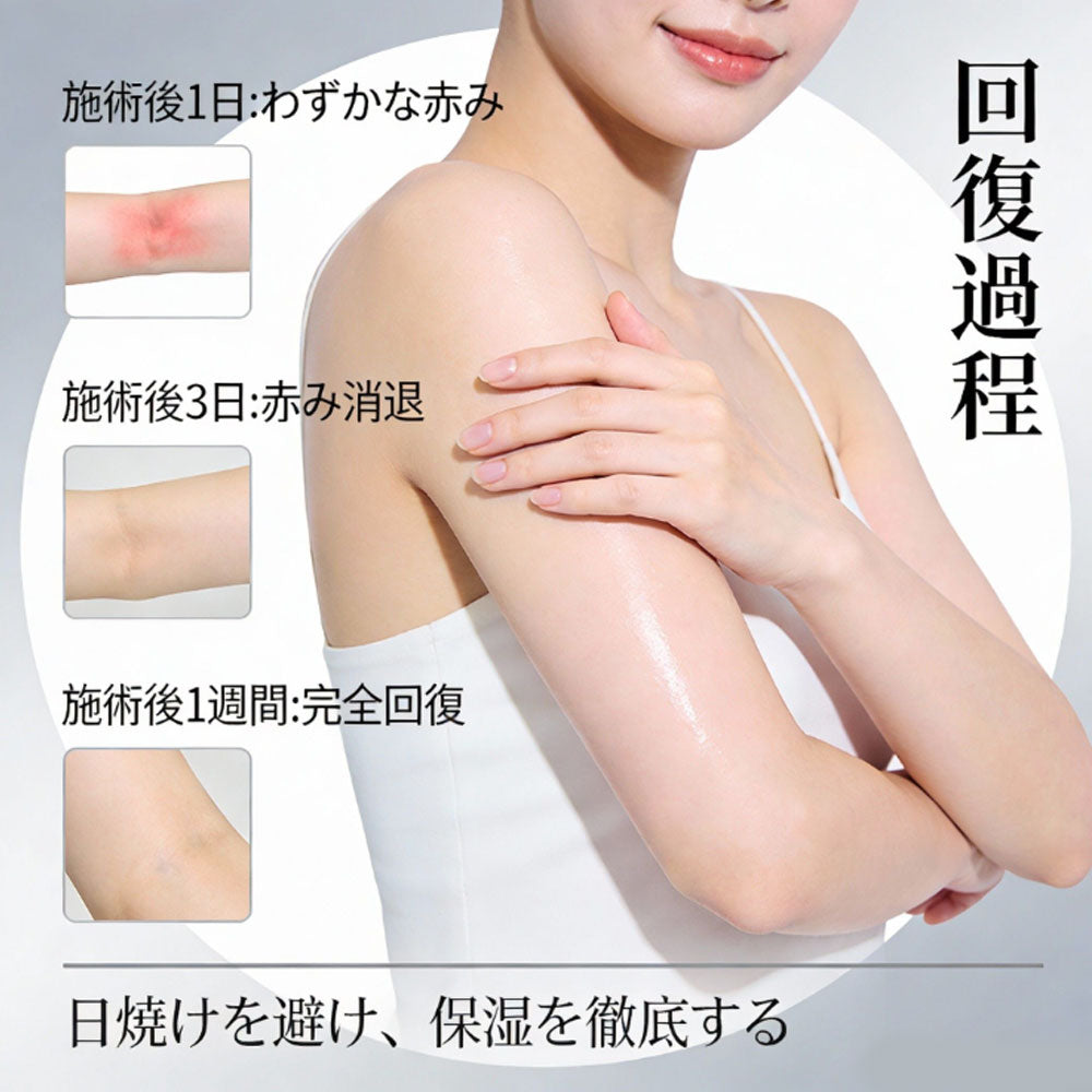 拒绝尴尬的脱毛术