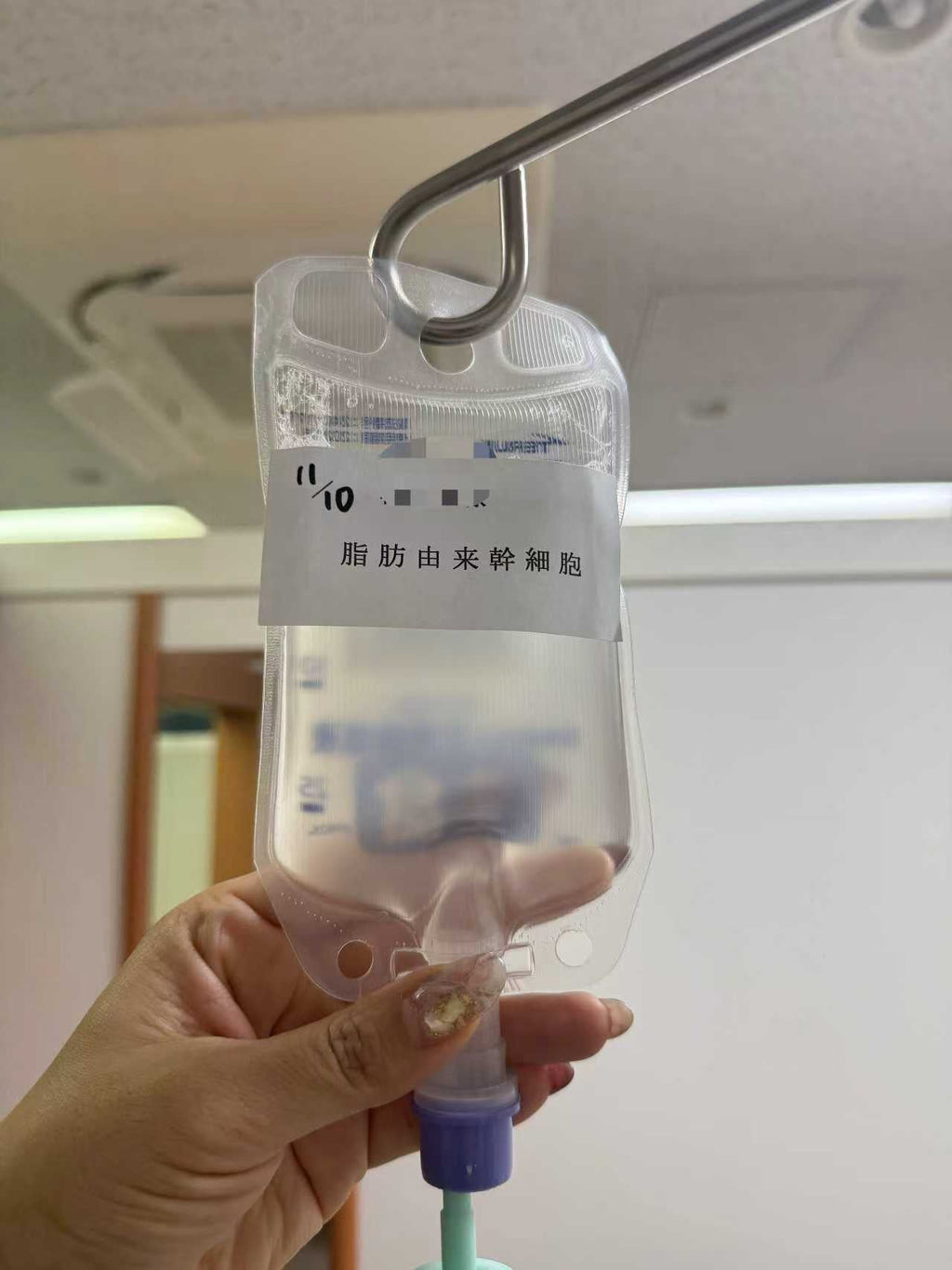 抗衰老干细胞注射