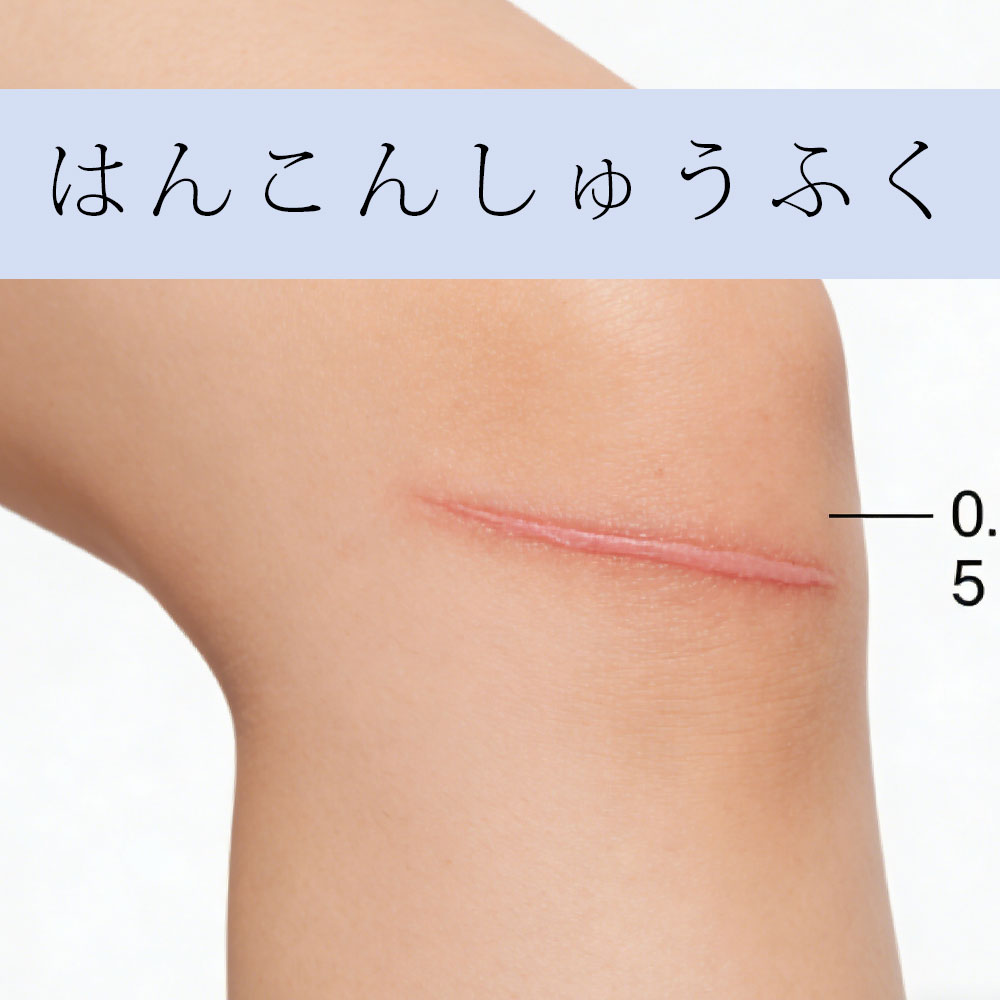 还原光滑肌肤，疤痕修复